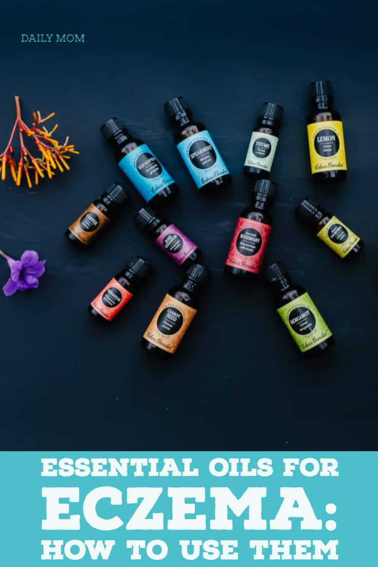 Essential Oils for Eczema Why and How to Use Them Daily Mom