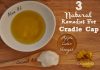 3 Natural Remedies For Cradle Cap