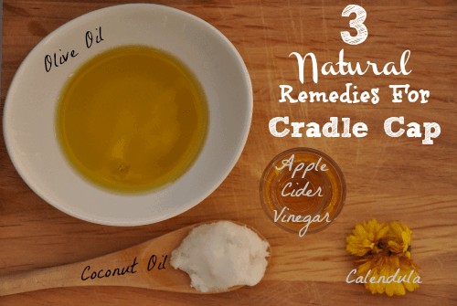 3 Natural Remedies For Cradle Cap