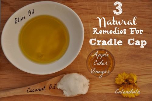 3 Natural Remedies For Cradle Cap 1 Daily Mom, Magazine For Families