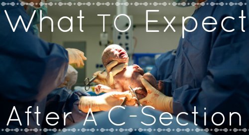 Life After C-Section: What To Expect After A C-Section 1 Daily Mom, Magazine For Families