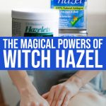 The ” Magic ” Powers Of Witch Hazel