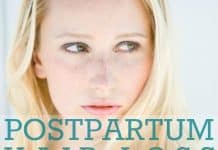 Postpartum Hair Loss
