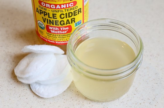 10 Amazing Health &Amp; Beauty Benefits Of Apple Cider Vinegar 3 Daily Mom, Magazine For Families