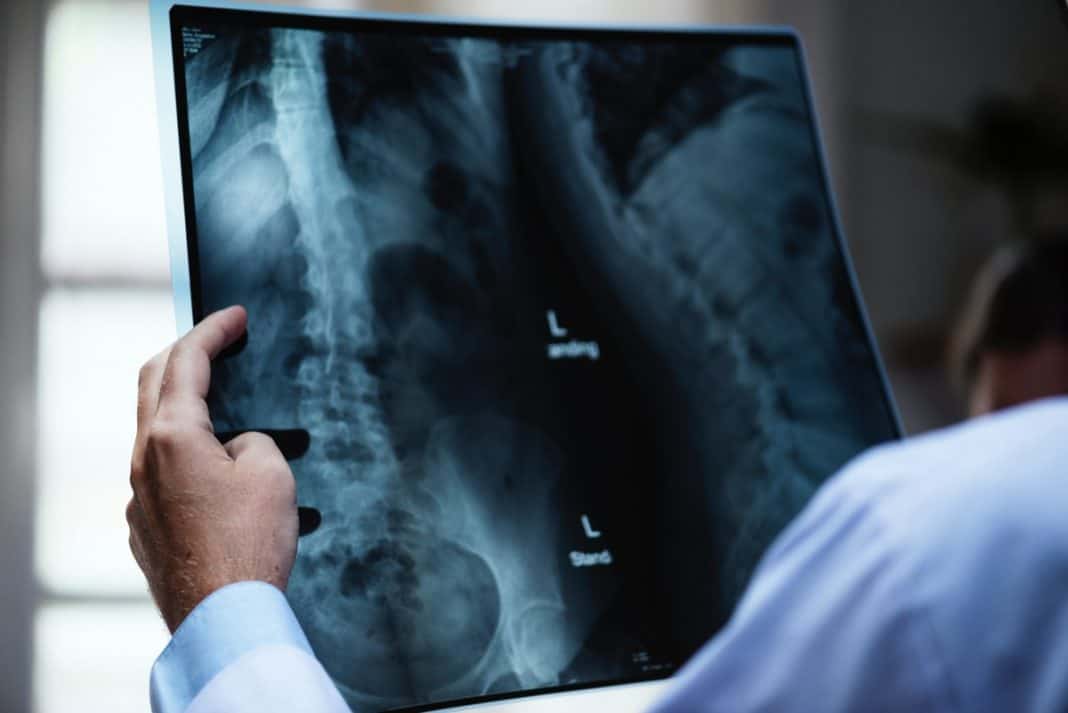Adjusting For Labor: Prenatal Chiropractic Care
