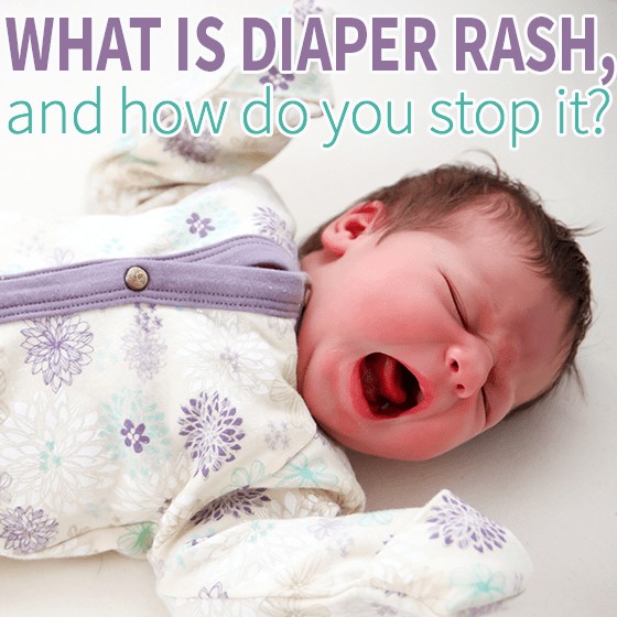 What Is Diaper Rash, And How Do You Stop It 1