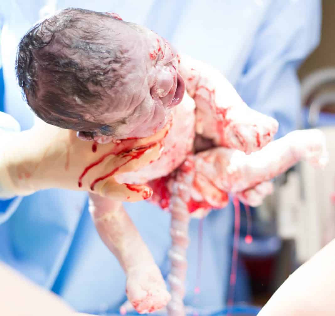 The Truth About Labor And Delivery: Everyone Poops