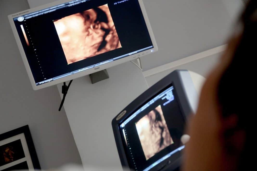 Ultrasound Gender: To See Or Not To See?