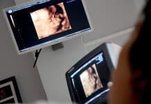 Ultrasound Gender: To See Or Not To See?