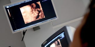 Ultrasound Gender: To See Or Not To See?