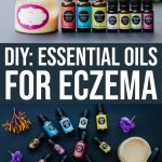 7 Effective Essential Oils For Eczema And Diy Eczema Cream