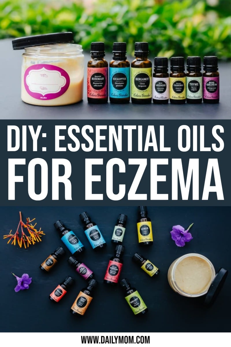 7 Effective Essential Oils For Eczema And DIY Eczema Cream