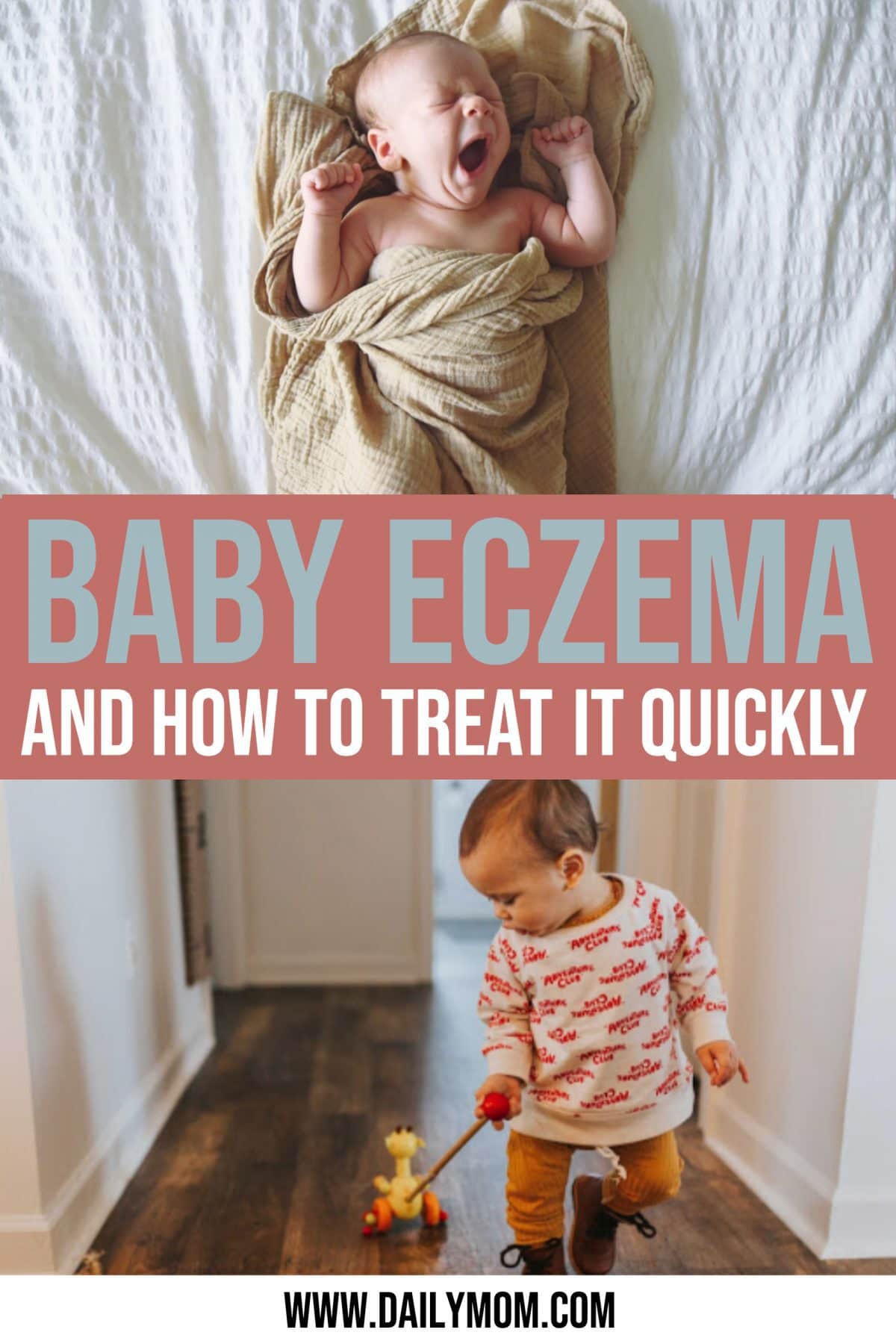 daily mom parent portal baby eczema