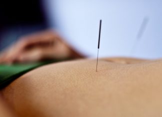 Acupuncture And Fertility: What You Need To Know