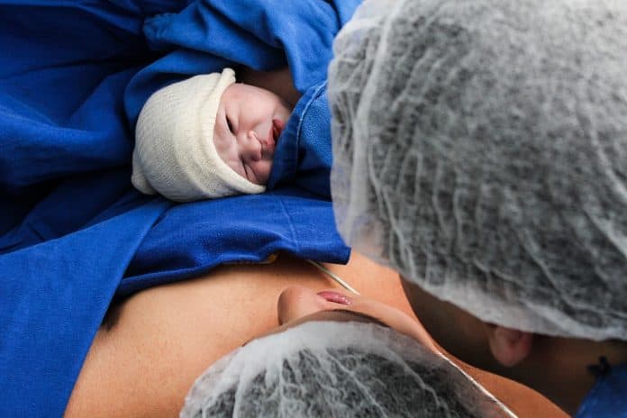 Preparing For A Repeat C-section