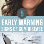 5 Early Warning Signs Of Gum Disease
