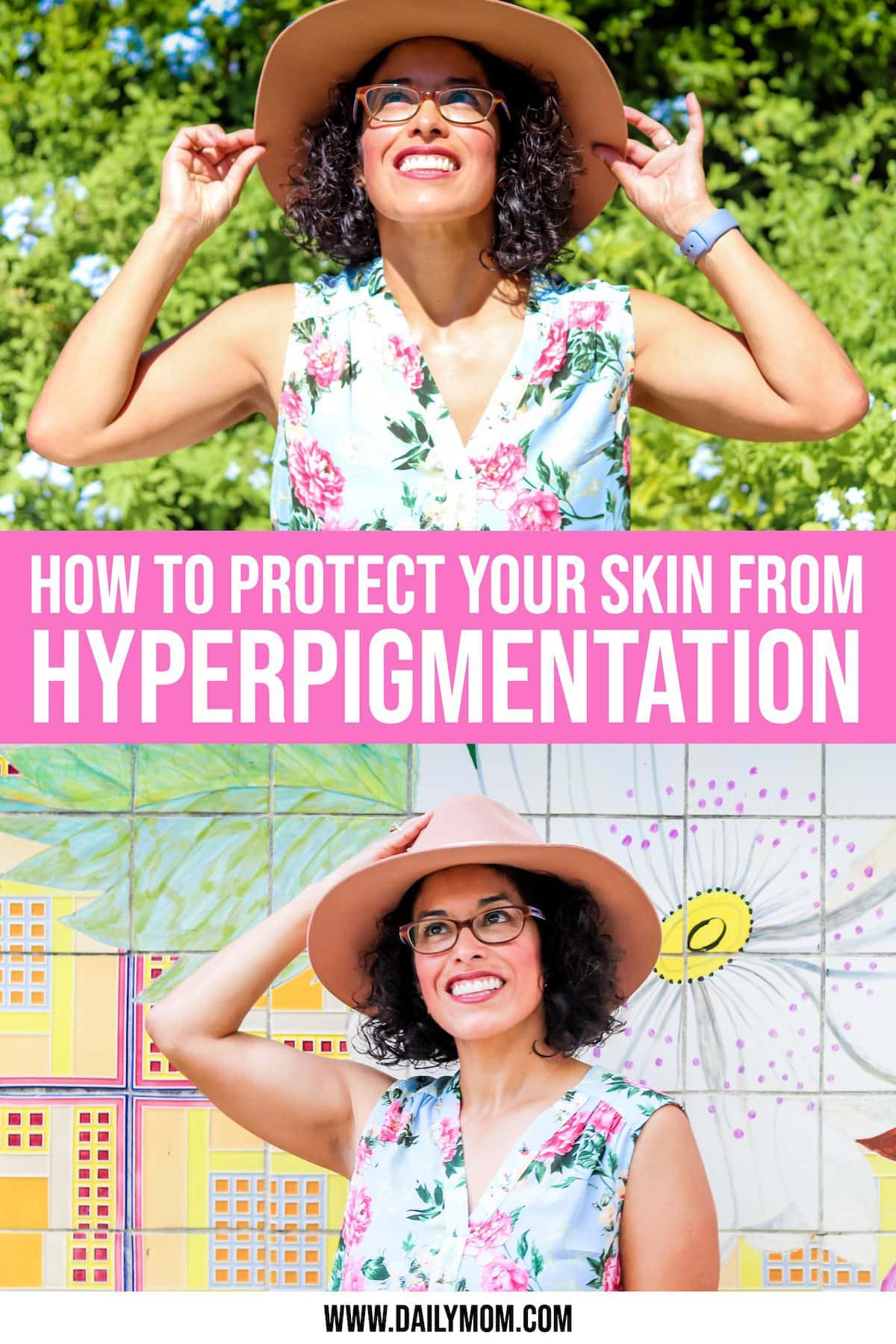 What Is Hyperpigmentation And How To Prevent It