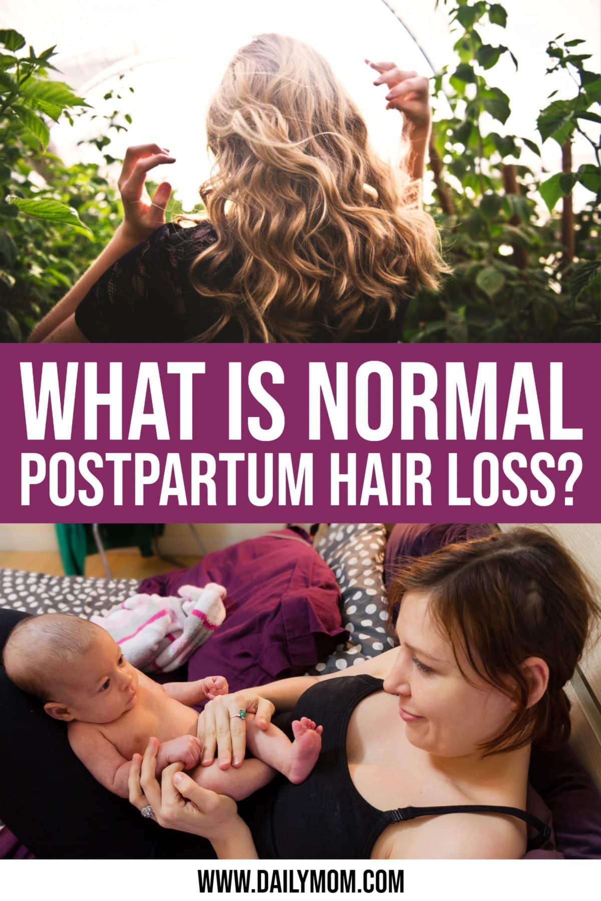 What Is Normal Postpartum Hair Loss?