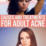 Acne Positivity And The Causes Of Adult Acne