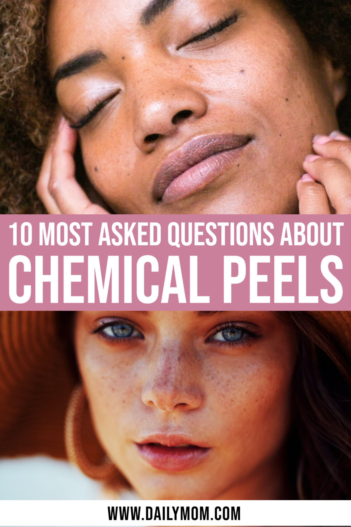 10 Most Asked Questions About Chemical Peels
