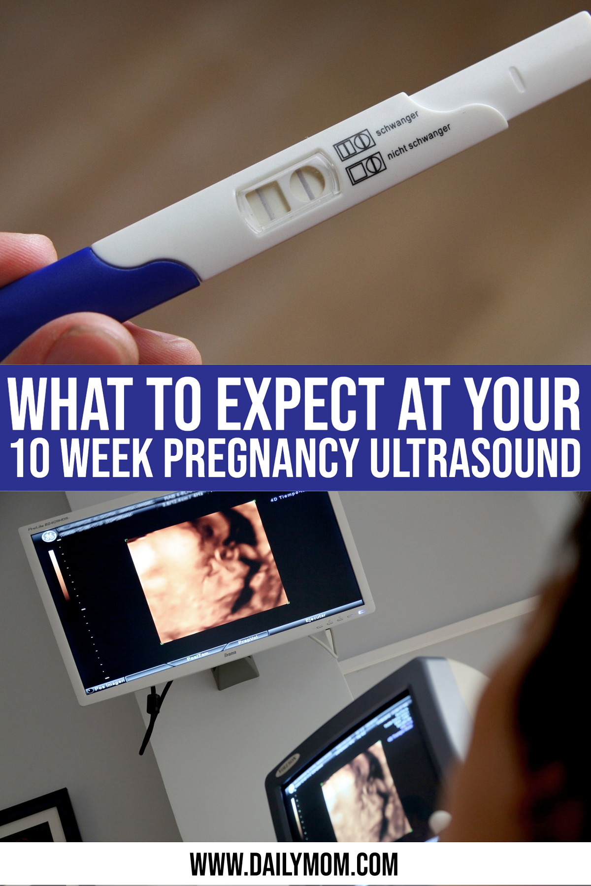 What To Expect At Your First Pregnancy Ultrasound