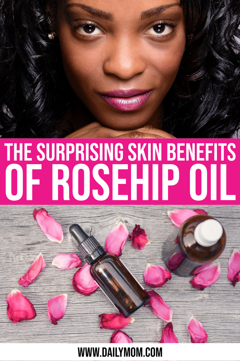 The Surprising Benefits Of Rosehip Oil For Your Skin