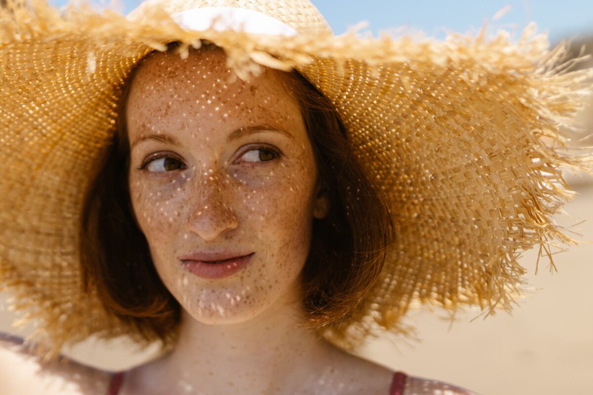 Powerful Relief: How To Treat Sunburn Fast In 6 Steps