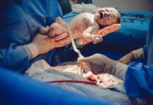 C-sections Might Not Be As Bad As You Think