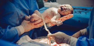 C-sections Might Not Be As Bad As You Think