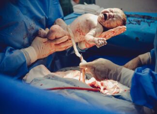 C-sections Might Not Be As Bad As You Think