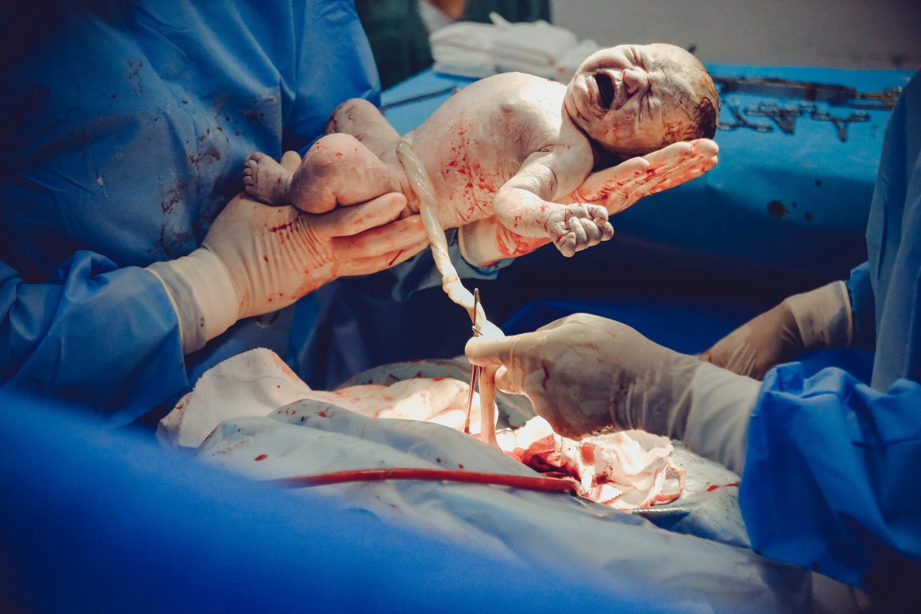 C-Sections Might Not Be As Bad As You Think