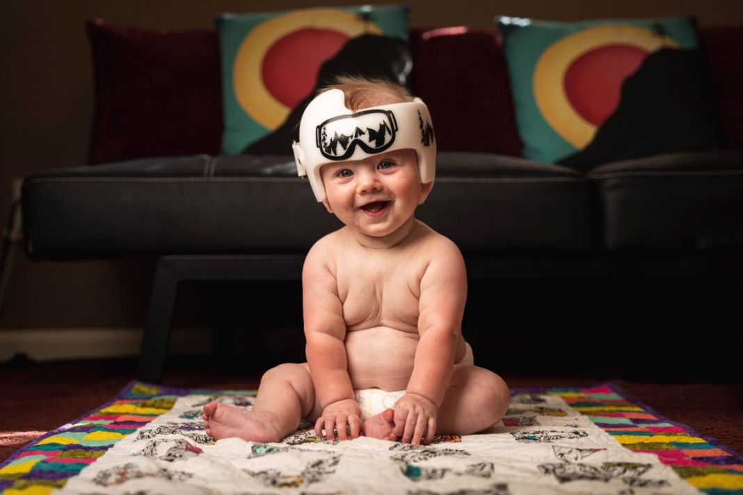daily mom parent portal helmet therapy