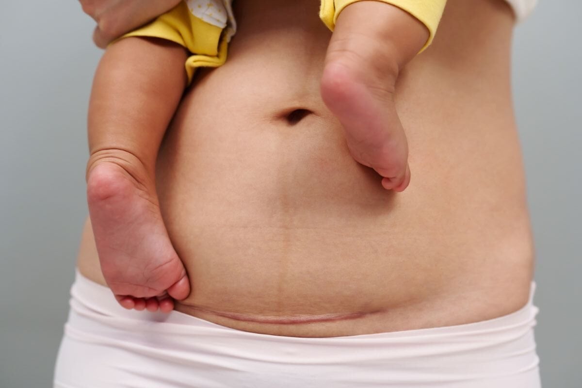 Planning a VBAC With Midwife: 6 Insights for a Vaginal Birth After Cesarean with Your Health Care Provider 4 Daily Mom, Magazine for Families Planning A Vbac With Midwife: 6 Insights For A Vaginal Birth After Cesarean With Your Health Care Provider 4 Daily Mom, Magazine For Families