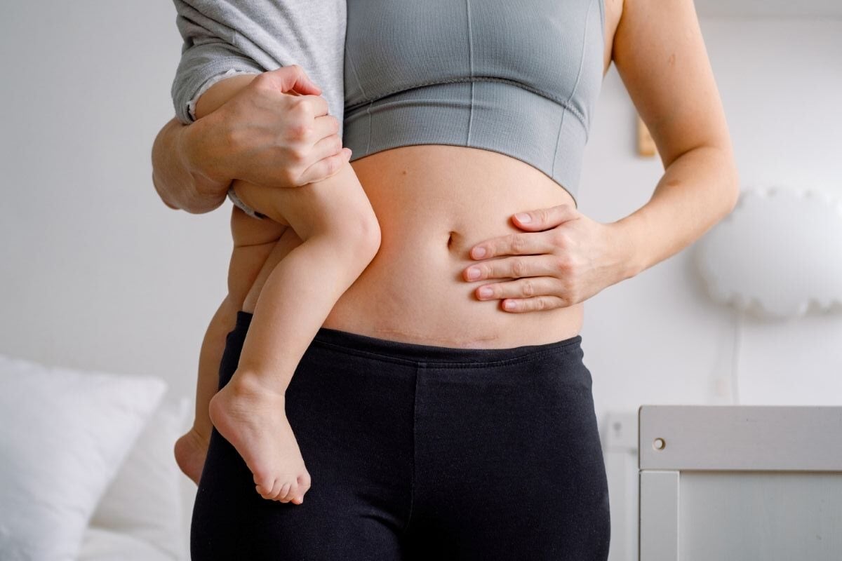 Planning a VBAC With Midwife: 6 Insights for a Vaginal Birth After Cesarean with Your Health Care Provider 1 Daily Mom, Magazine for Families Planning A Vbac With Midwife: 6 Insights For A Vaginal Birth After Cesarean With Your Health Care Provider 1 Daily Mom, Magazine For Families