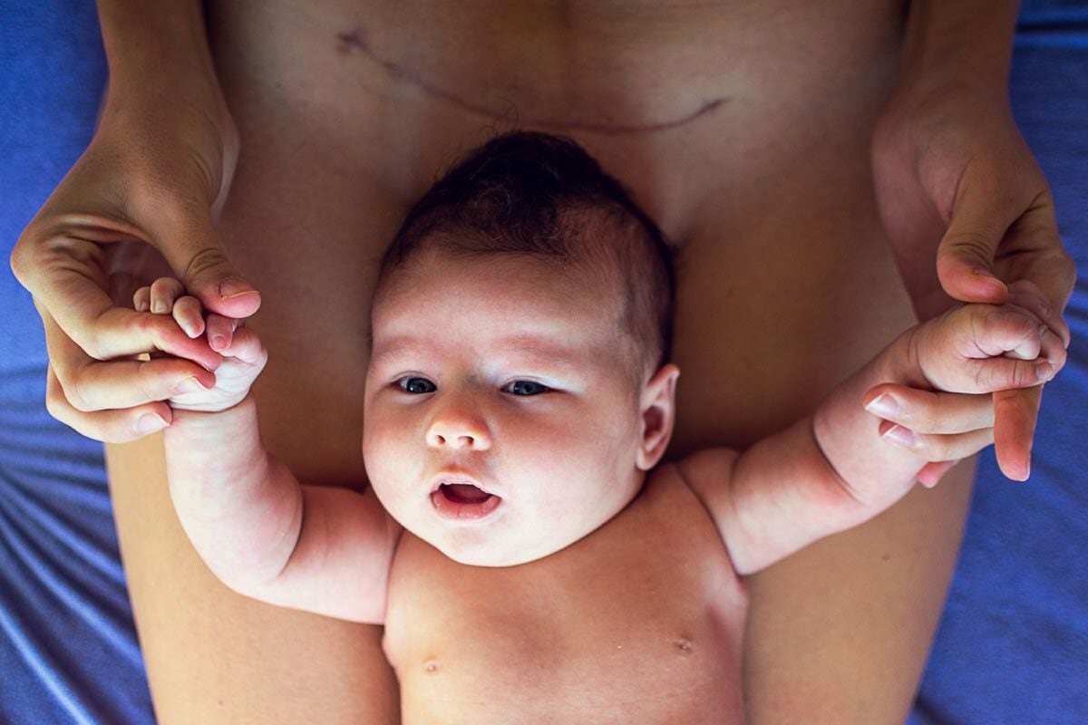 Planning a VBAC With Midwife: 6 Insights for a Vaginal Birth After Cesarean with Your Health Care Provider 3 Daily Mom, Magazine for Families Planning A Vbac With Midwife: 6 Insights For A Vaginal Birth After Cesarean With Your Health Care Provider 3 Daily Mom, Magazine For Families