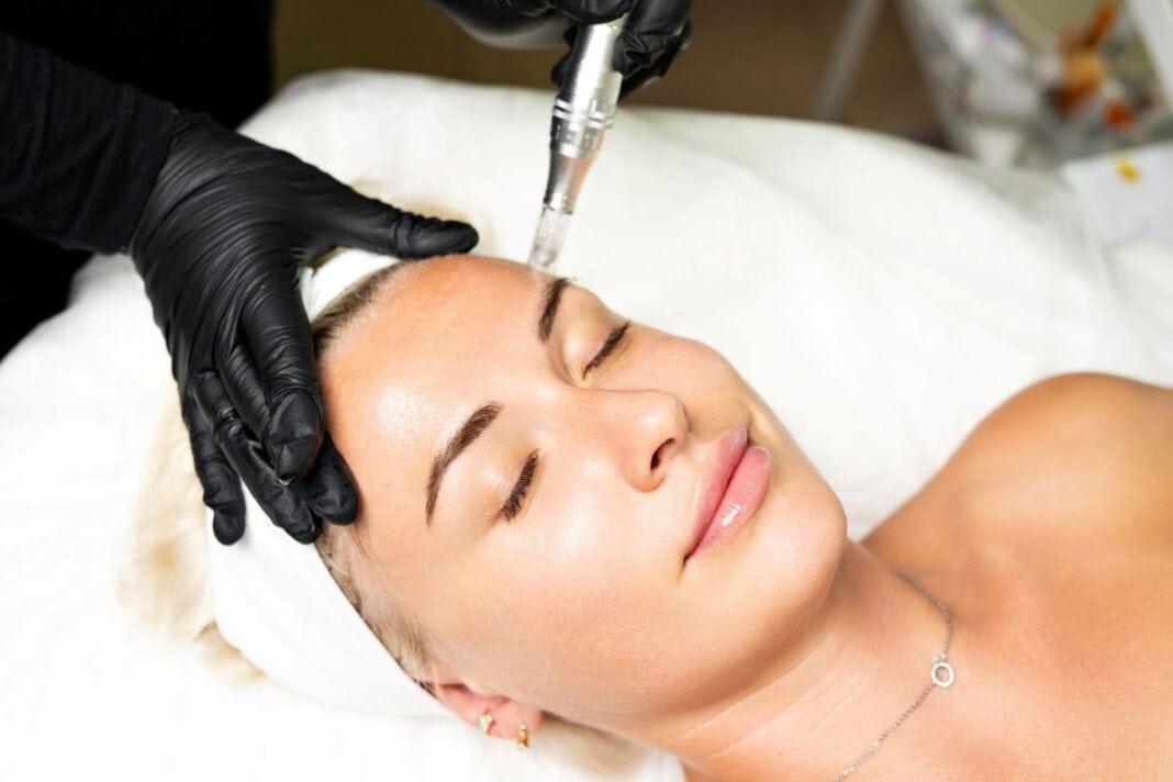micro needling while pregnant