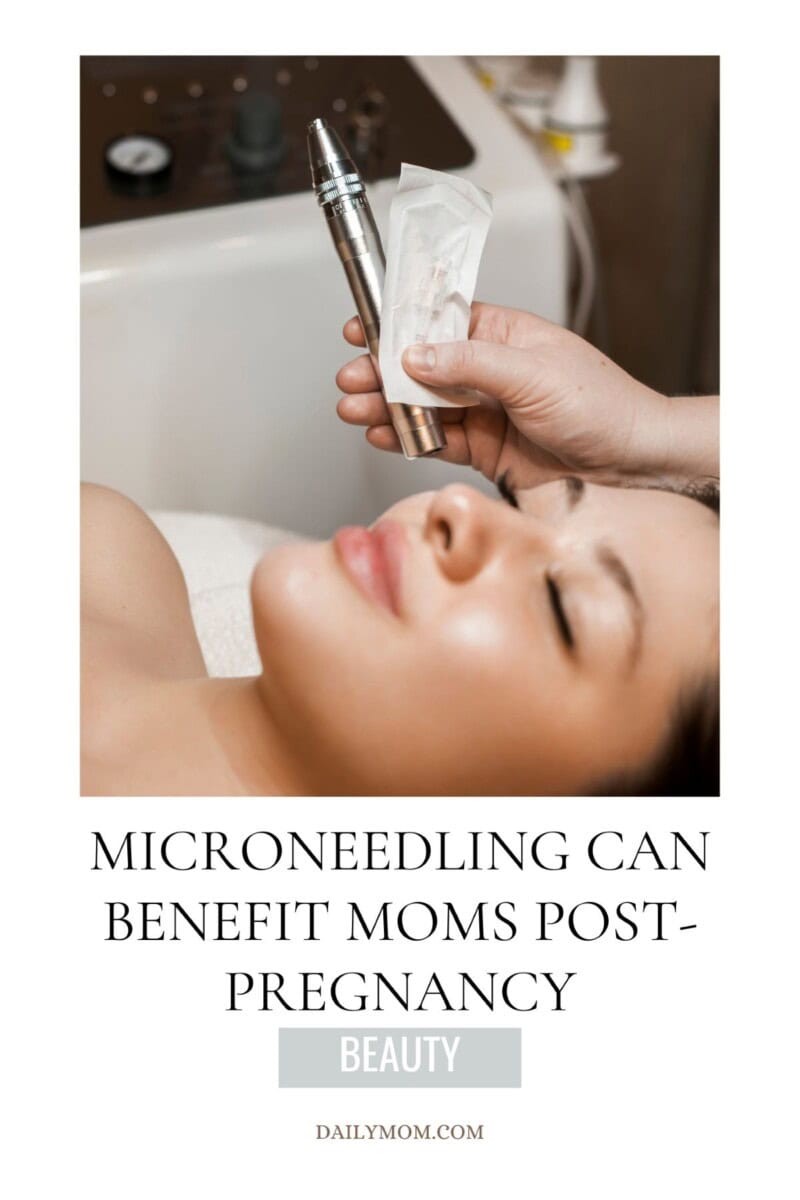 Micro Needling While Pregnant: What Skin Treatments Are Pregnancy Safe &Amp; Can You Get Skin Needling During Pregnancy 6 Daily Mom, Magazine For Families
