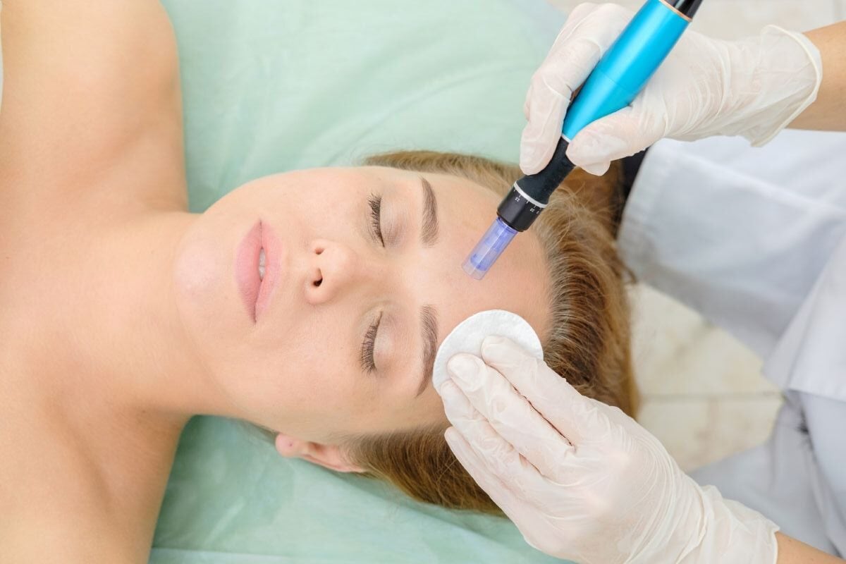 Micro Needling While Pregnant: What Skin Treatments Are Pregnancy Safe &Amp; Can You Get Skin Needling During Pregnancy 2 Daily Mom, Magazine For Families