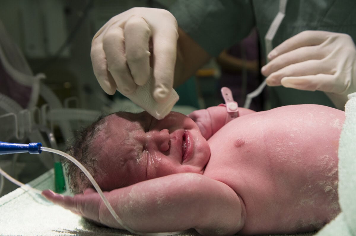 Vbac Birth: Vaginal Birth After Cesarean Section, Benefits And Repeat Risks With A C-Section 1 Daily Mom, Magazine For Families