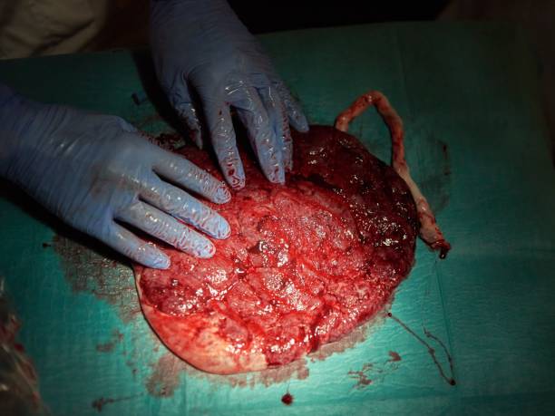 Placenta Encapsulation Certification Training: A Path to Purposeful Work in Postpartum Care 5 Daily Mom, Magazine for Families Placenta Encapsulation Training