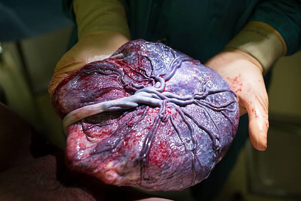Placenta Encapsulation Certification Training: A Path to Purposeful Work in Postpartum Care 2 Daily Mom, Magazine for Families Placenta Encapsulation Certification Training: A Path To Purposeful Work In Postpartum Care 2 Daily Mom, Magazine For Families